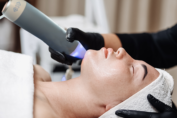 Exion Microneedling