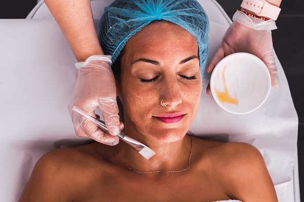 Brightening Peels